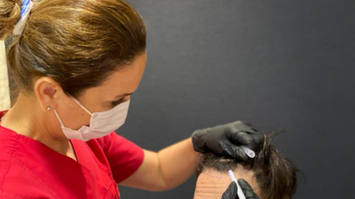 Dünyanın Saç Ekimi başkenti artık İstanbul!