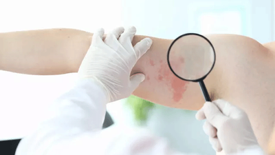 Koronavirüsün bir belirtisi daha ortaya çıktı 