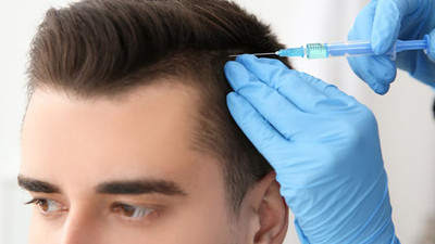 Saç ekimi ne kadar sürer?