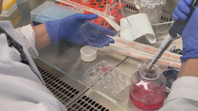 Tıp dünyasında heyecanlandıran gelişme: HIV’i yenen ilk kadın