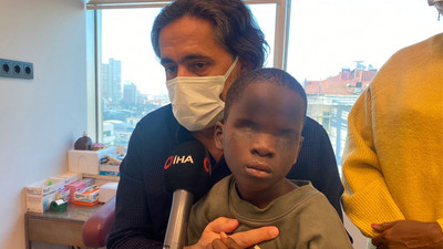 Üvey annesi asitle gözünü yaktı: Türkiye'ye getirildi!