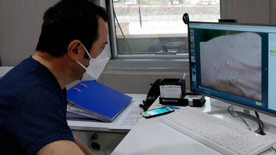 Öğrenci yurtlarında uyuz paniği! Tedavi önemli, hastanede sıra yok