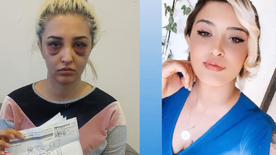 Sevgilisinden ayrılmak isteyen genç kadın dehşet dolu anlar yaşadı