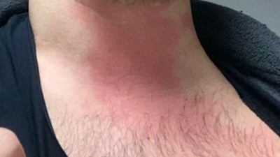 Uzman çavuş, doktora saldırdı