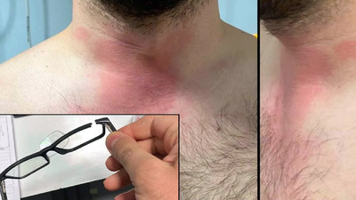 Valilikten doktoru darbeden uzman çavuş hakkında açıklama