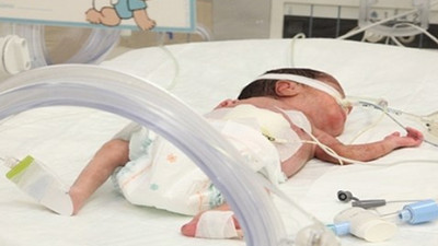 Doğmakta olan bebeği rahme geri itti! '1974'ten bu yana böyle bir olay yaşanmadı'