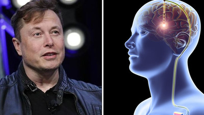 Elon Musk'tan kilo vermeye yardımcı dikkat çeken proje: Beyin çipi