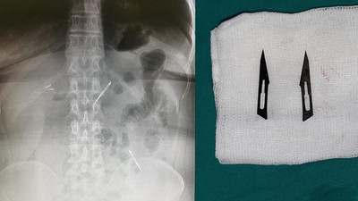 Karın ağrısı şikayetiyle gitti, hastanede öğrendiği karşısında şok oldu