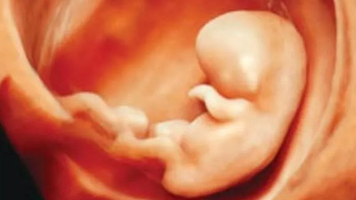 Kürtaj karşıtı kadının evinden beş adet fetüs çıktı