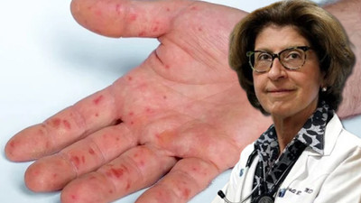 Dünyanın konuştuğu Türk doktor...