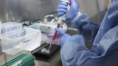 Türkiye'de maymun çiçeği virüsü tespit edildi iddiası