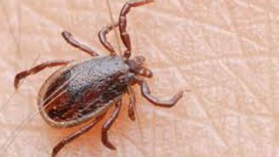 Uzmanından 'kene çıkarma' teknikleri