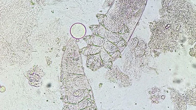 Yüzümüzde yaşıyor, temasla bulaşıyorlar