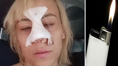 Çakmak istedi; olumsuz yanıt alınca genç kadına kafa attı