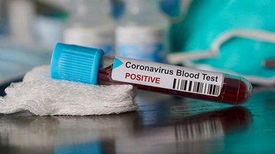 Covid geçirenlere '10 gün' uyarısı