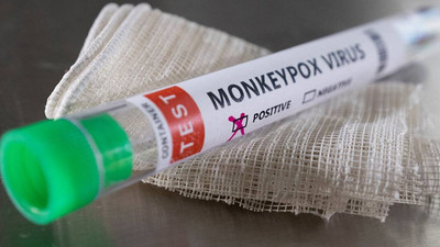 DSÖ'den maymun çiçeğine ilişkin açıklama: Özellikle endişe verici yapan şey...