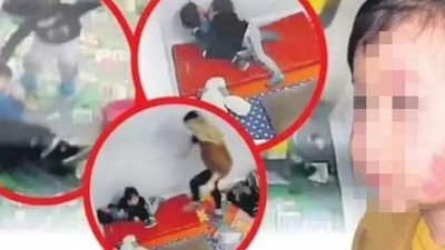 İstanbul'da skandal olay: 17 aylık bebek darp edildi! Makyajla yaralarını gizlediler