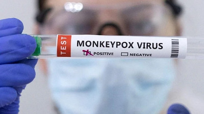 Komşuda ilk maymun çiçeği vakası görüldü