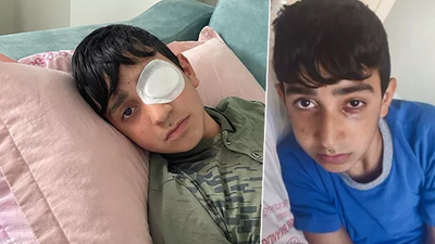 Ortaokulda 'kız arkadaşıma mesaj atmışsın' kavgası, bir çocuğun görme kaybına yol açtı