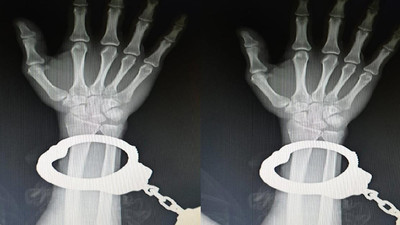 TTB’yi harekete geçiren röntgen 