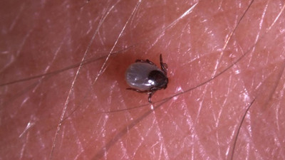 Vaka sayısında büyük artış: Bir kişi daha kene ısırığı nedeniyle hayatını kaybetti