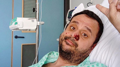 Dünya Sağlık Örgütü'nden maymun çiçeğine yakalanan Türk vatandaşı paylaşımı