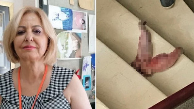 Ev hapsi cezası verilmişti: Esin Davutoğlu Şenol'u tehdit eden şahıs elektronik kelepçeyi kırdı