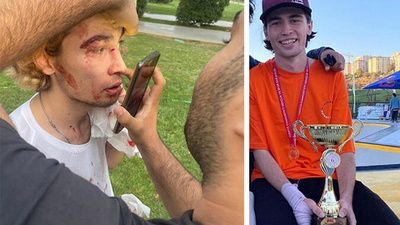 Kaykay şampiyonu milli sporcu öldüresiye darp edildi