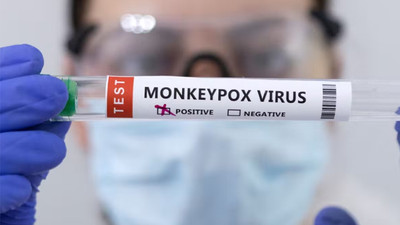 Maymun çiçeği için kırmızı alarm: ABD'de acil durum ilan edildi