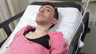 Zihinsel engelli Arlen, sokak ortasında darp edildi