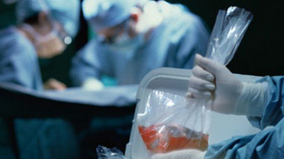 ABD'de organ nakli sayısı 1 milyona ulaştı