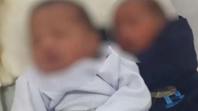 Bilim dünyası şoke oldu: İkizlerin anneleri aynı fakat babaları farklı