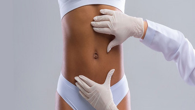 Karın Germe Ameliyatı (Abdominoplasty)