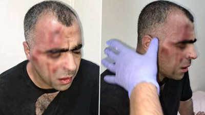 Gazeteci Aygül'e saldırıda yeni gelişme: Koruma polisi açığa alındı