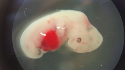 Yumurta ve sperm olmadan insan embriyosu oluşturdular