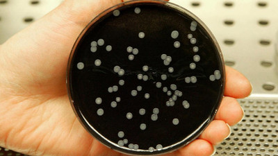 Polonya'da lejyonella bakterisi nedeniyle ölenlerin sayısı 11'e yükseldi