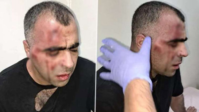 Gazeteci Aygül'e saldırıda belediye başkanı hakkında karar verildi