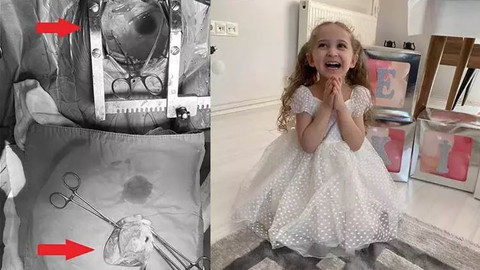 Tıp mucizesi: Minik kalbini söküp tekrar yerleştirdiler