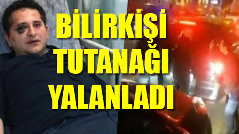 Erdoğan'ın korumalarının darp ettiği avukat olayında yeni skandal