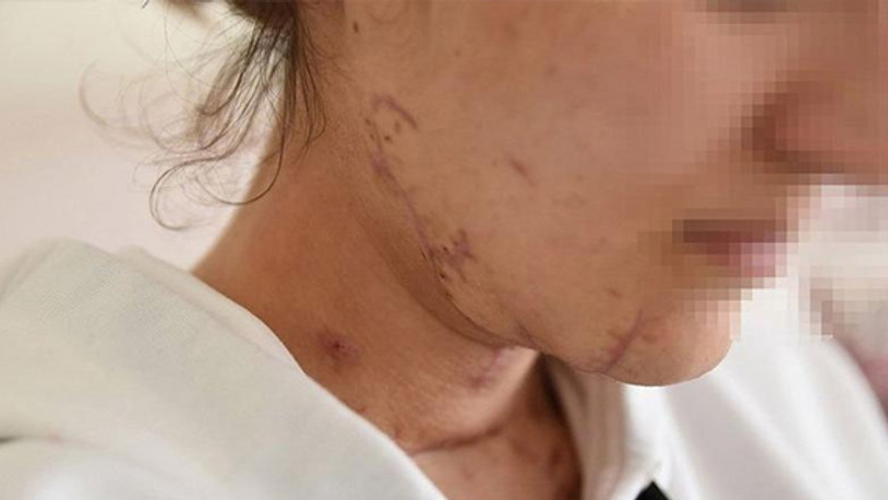 İşkence yaptı, tecavüz etti, boğazını kesti, arabayla üzerinden geçti...