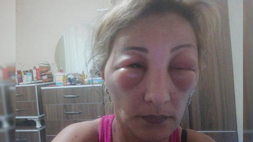 Röfle yaptırdı, neredeyse ölüyordu