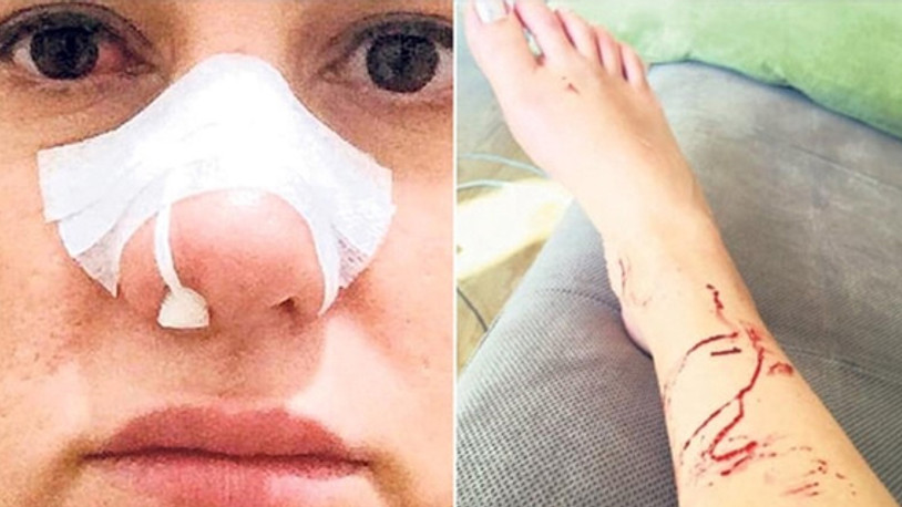 Çıplak fotoğraflarla şantaj iddiasından sonra oyuncu sevgili hakkında darp iddiası!