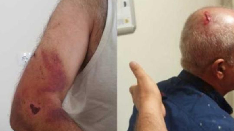 Engelli kız ve babasına ‘Bana niye oy vermedin’ dayağı