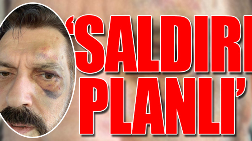 SONAR Araştırma Şirketi'nin sahibine saldırı!