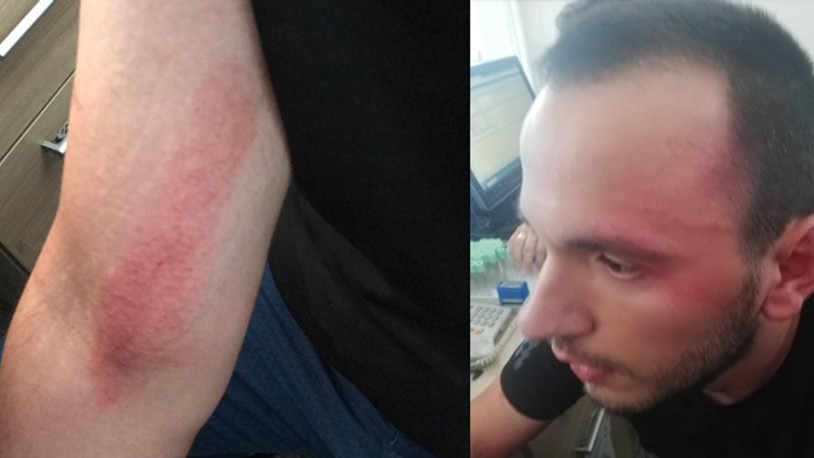 Doktordan özel harekat polislerine darp suçlaması