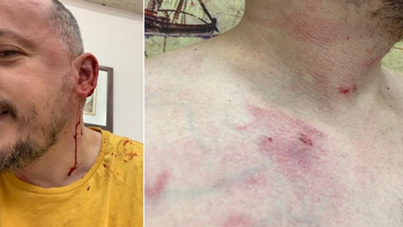 Gezgin Fatih Koparan'a saldırı: Defalarca 155'i aradım, ölmem mi gerekiyor?