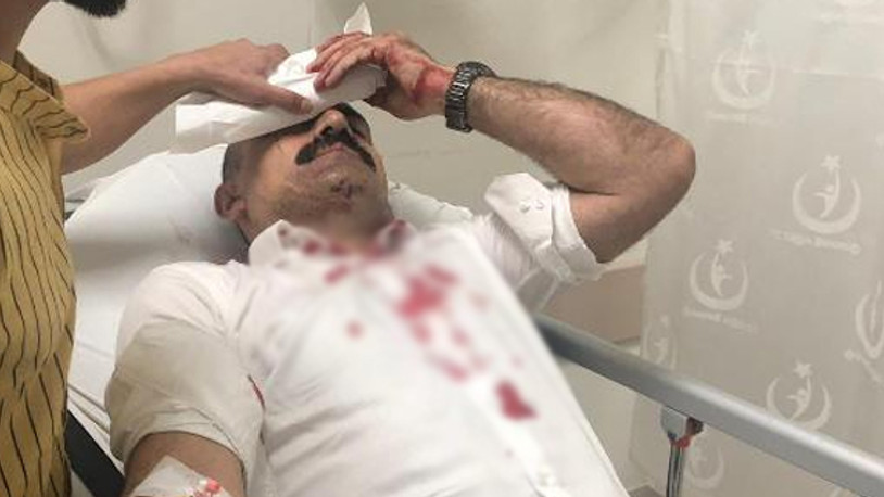 Sendika başkanına muştalı saldırı