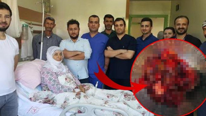 Kalbinden 400 gramlık tümör çıkarıldı