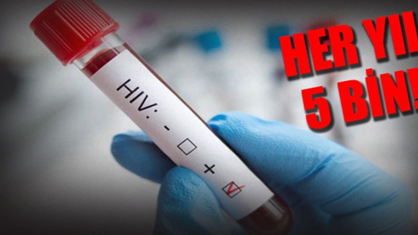HIV, Türkiye’de son 5 yılda yüzde 400 arttı