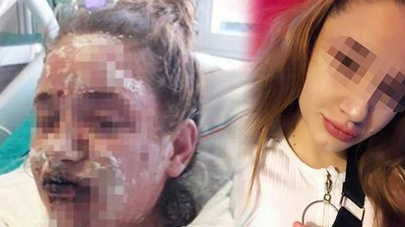 17 yaşındaki Mina kullandığı ilaç yüzünden kör oldu